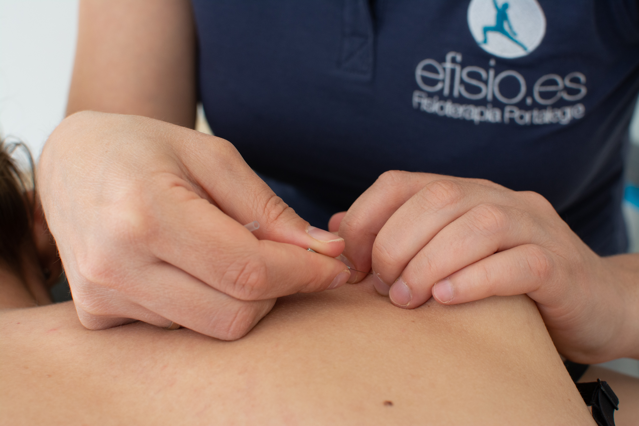 ¿Cuándo Acudir al Fisioterapeuta?