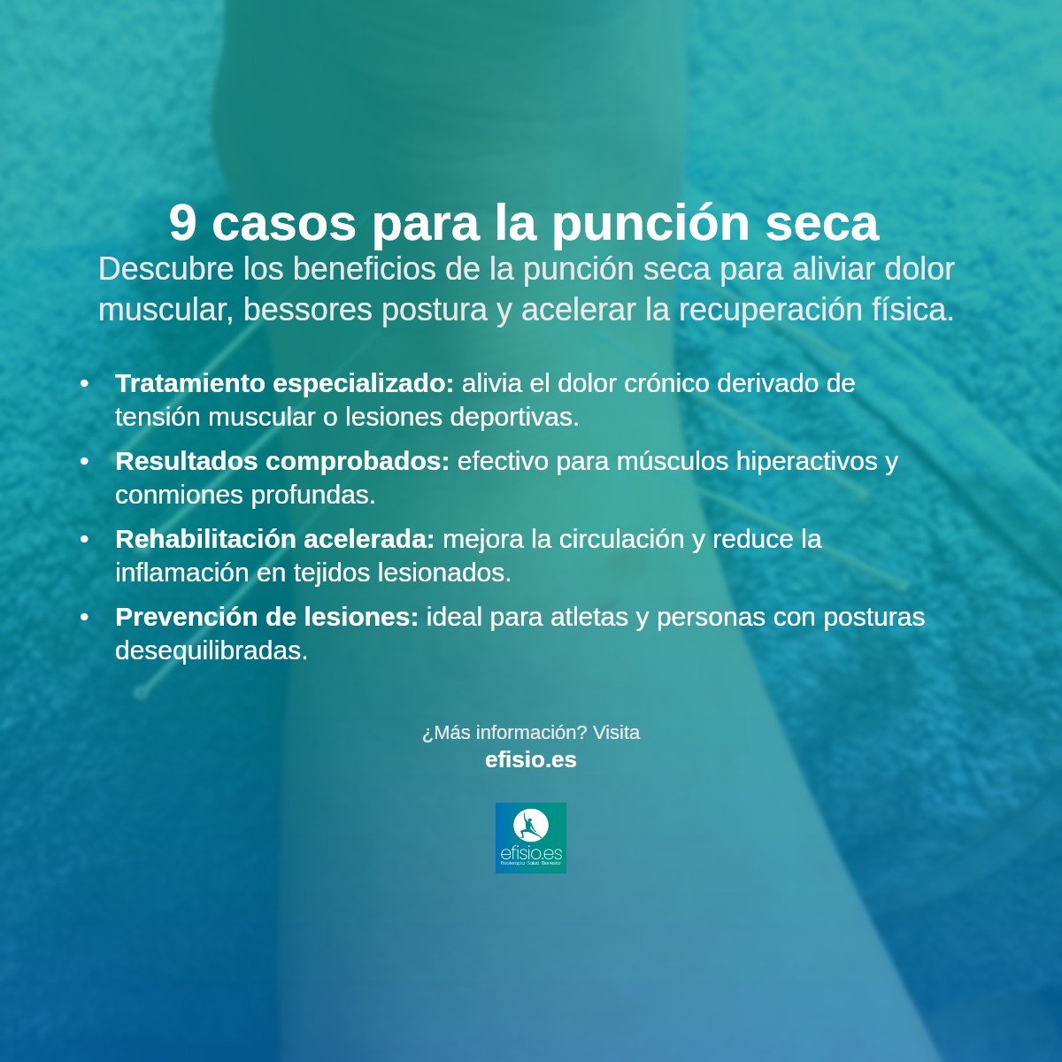 ¿Neuroma de Morton? El Diagnóstico que Desafía a los Corredores