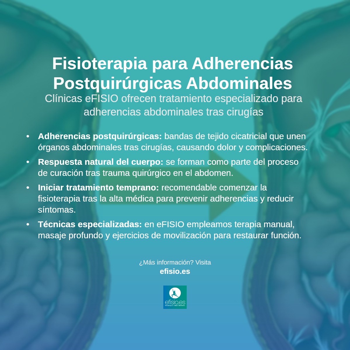 Imagen resumen sobre Adherencias Postquirúrgicas en el Abdomen