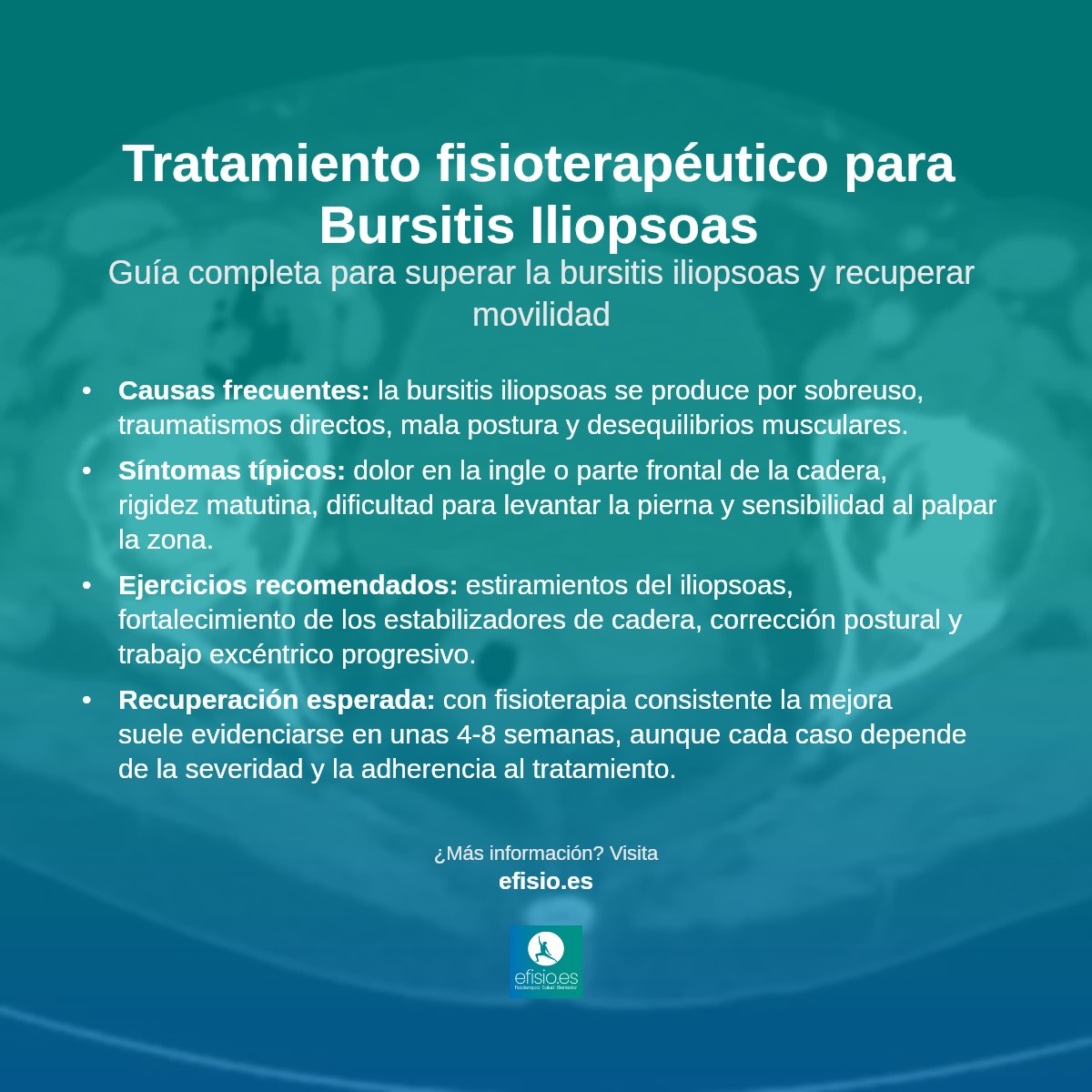 Imagen resumen sobre Bursitis Iliopsoas