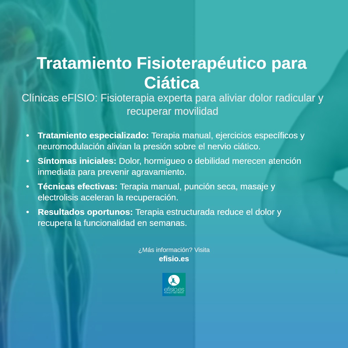 Imagen resumen sobre Ciática (Dolor Radicular Lumbar)