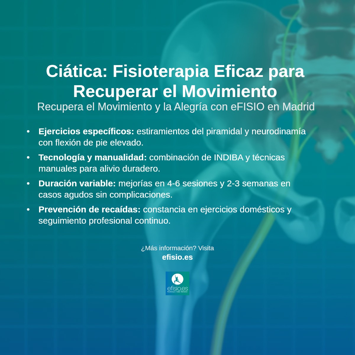 Imagen resumen sobre Ciática