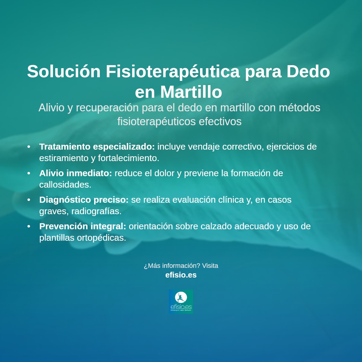 Imagen resumen sobre Dedo del Pie en Martillo