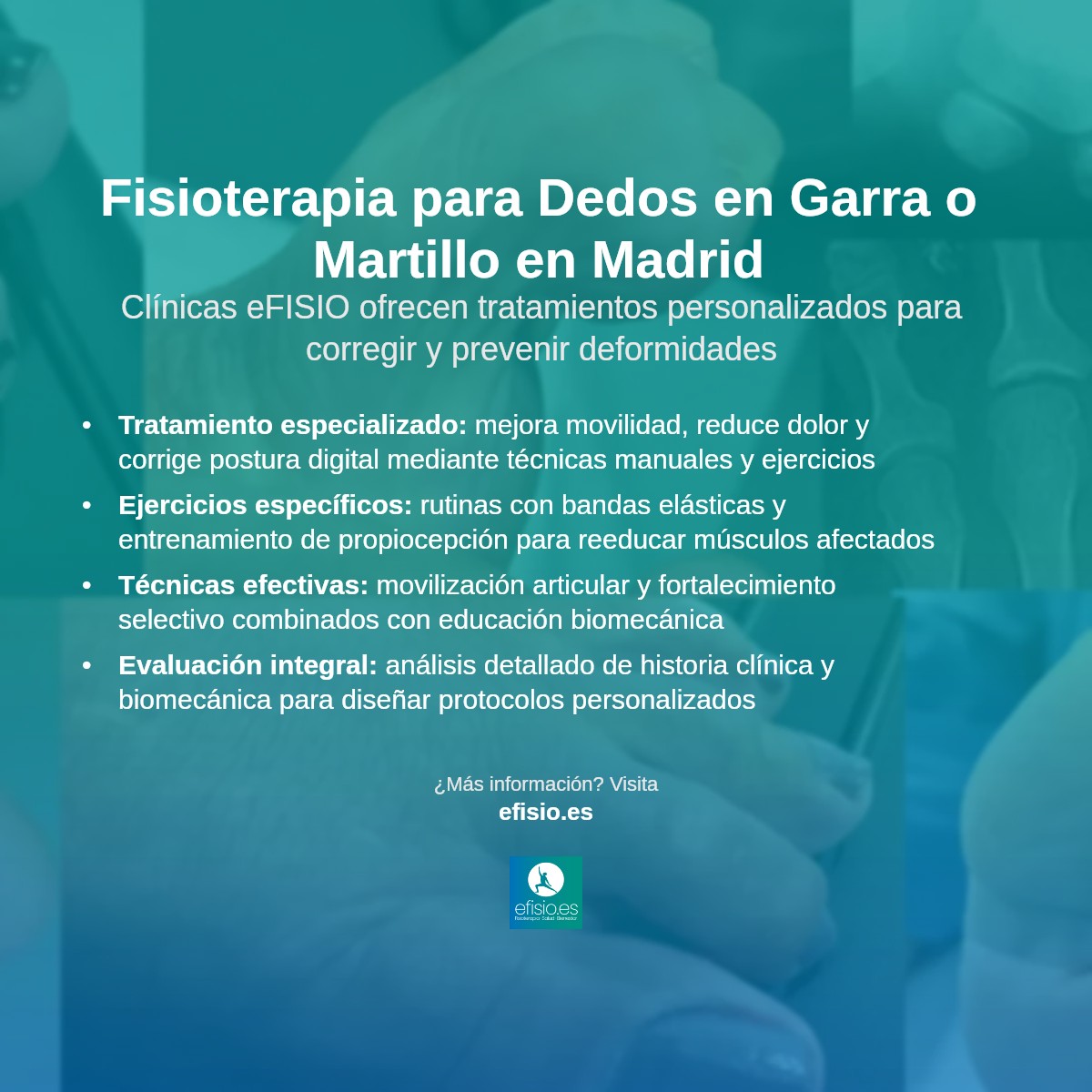 Libera Tu Mano: Fisioterapia Para El Dedo En Gatillo