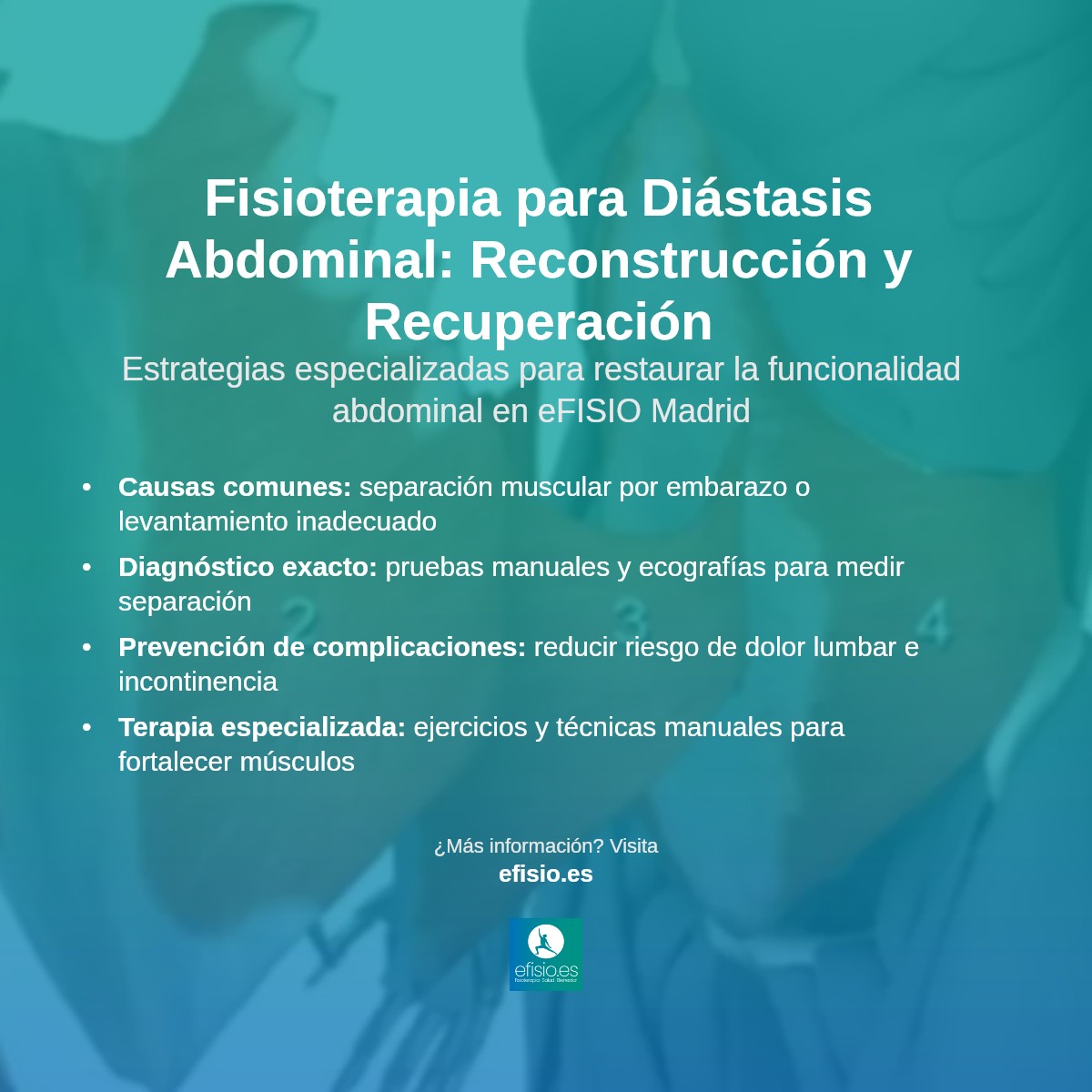 Imagen resumen sobre Diástasis de los rectos abdominales