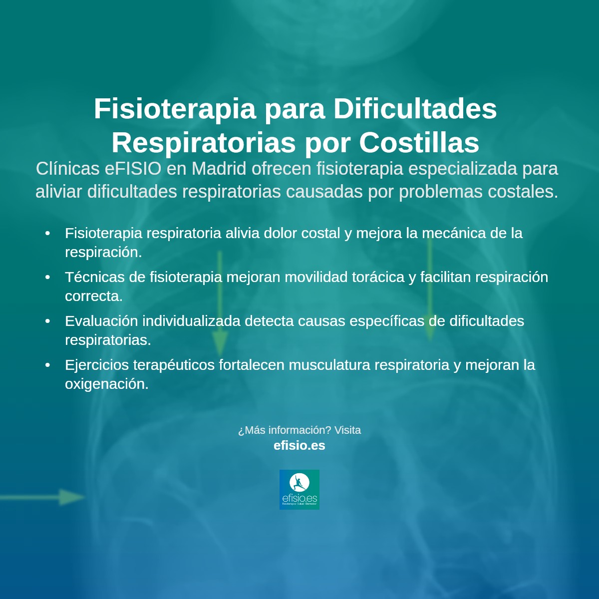 Imagen resumen sobre Dificultades Respiratorias Relacionadas con Costillas