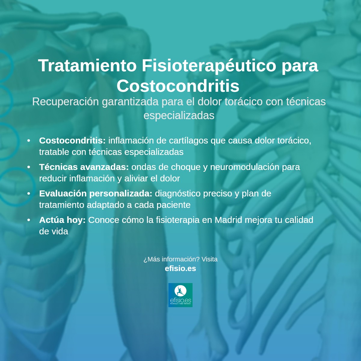 Imagen resumen sobre Dolor Costal (Costocondritis)
