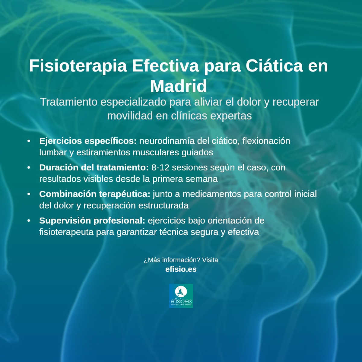 Imagen resumen sobre Dolor del Nervio Ciático