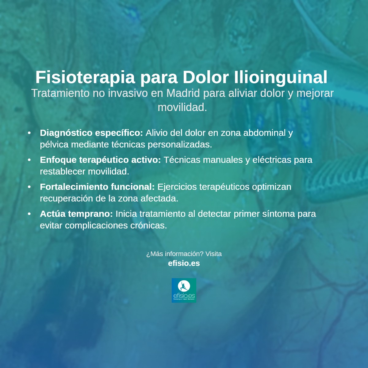 Imagen resumen sobre Dolor del Nervio Ilioinguinal