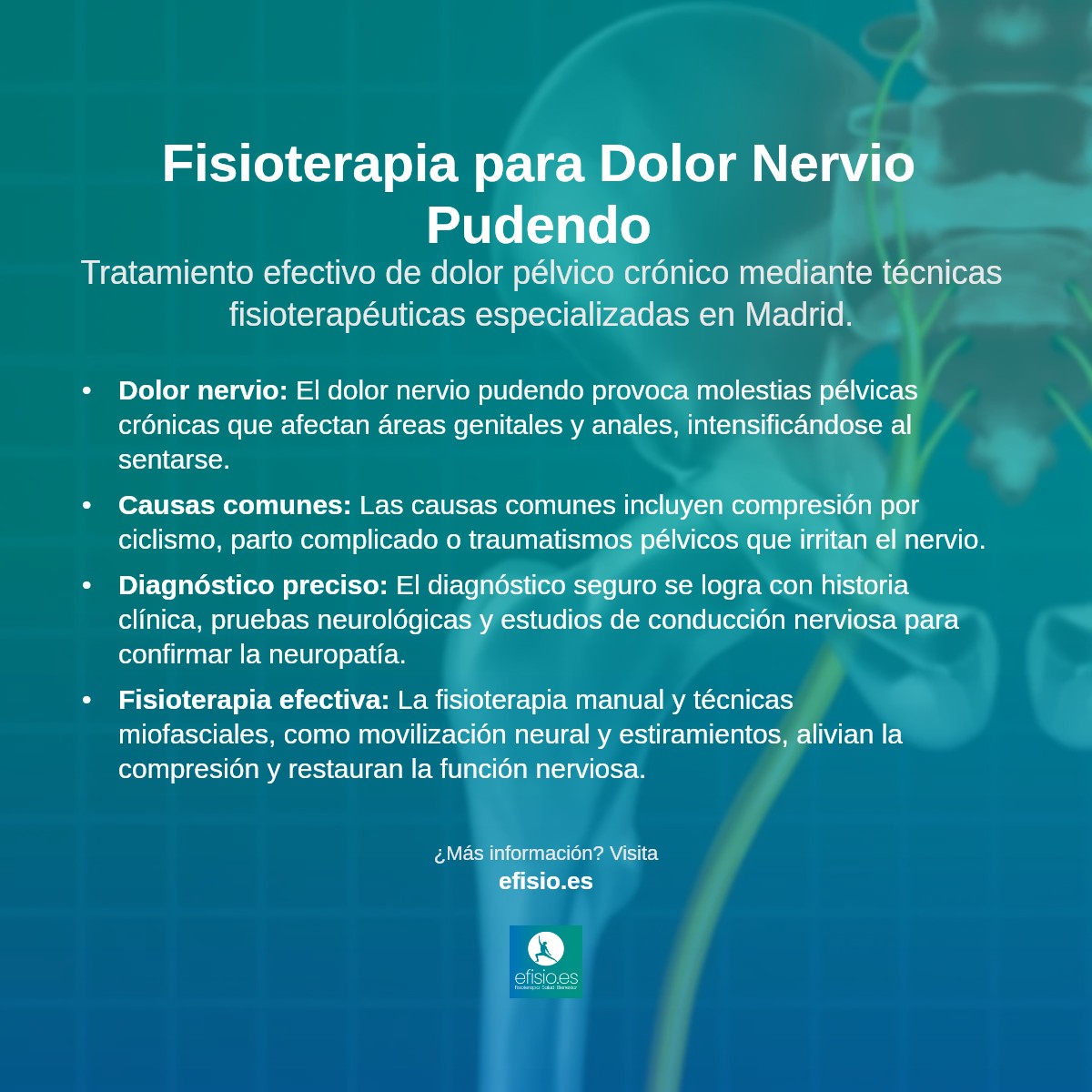 Imagen resumen sobre Dolor del Nervio Pudendo