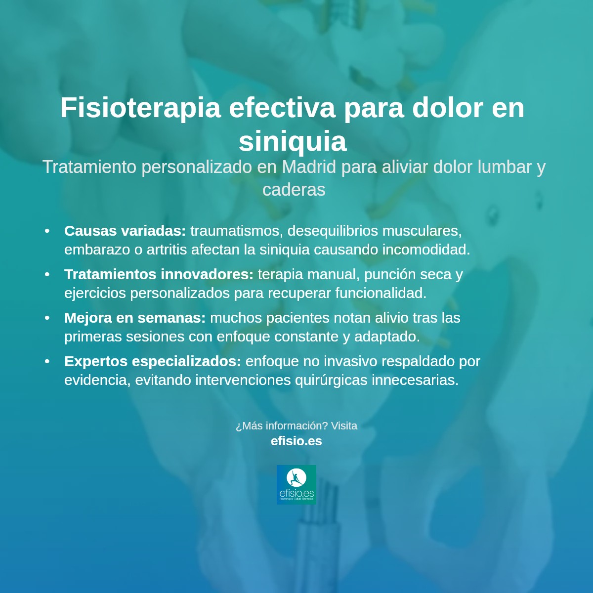 Imagen resumen sobre Dolor en la Base de la Articulación Sacroilíaca