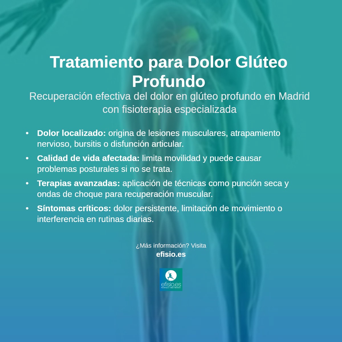 Imagen resumen sobre Dolor glúteo profundo