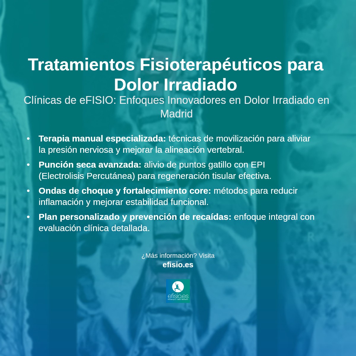 Imagen resumen sobre Dolor irradiado