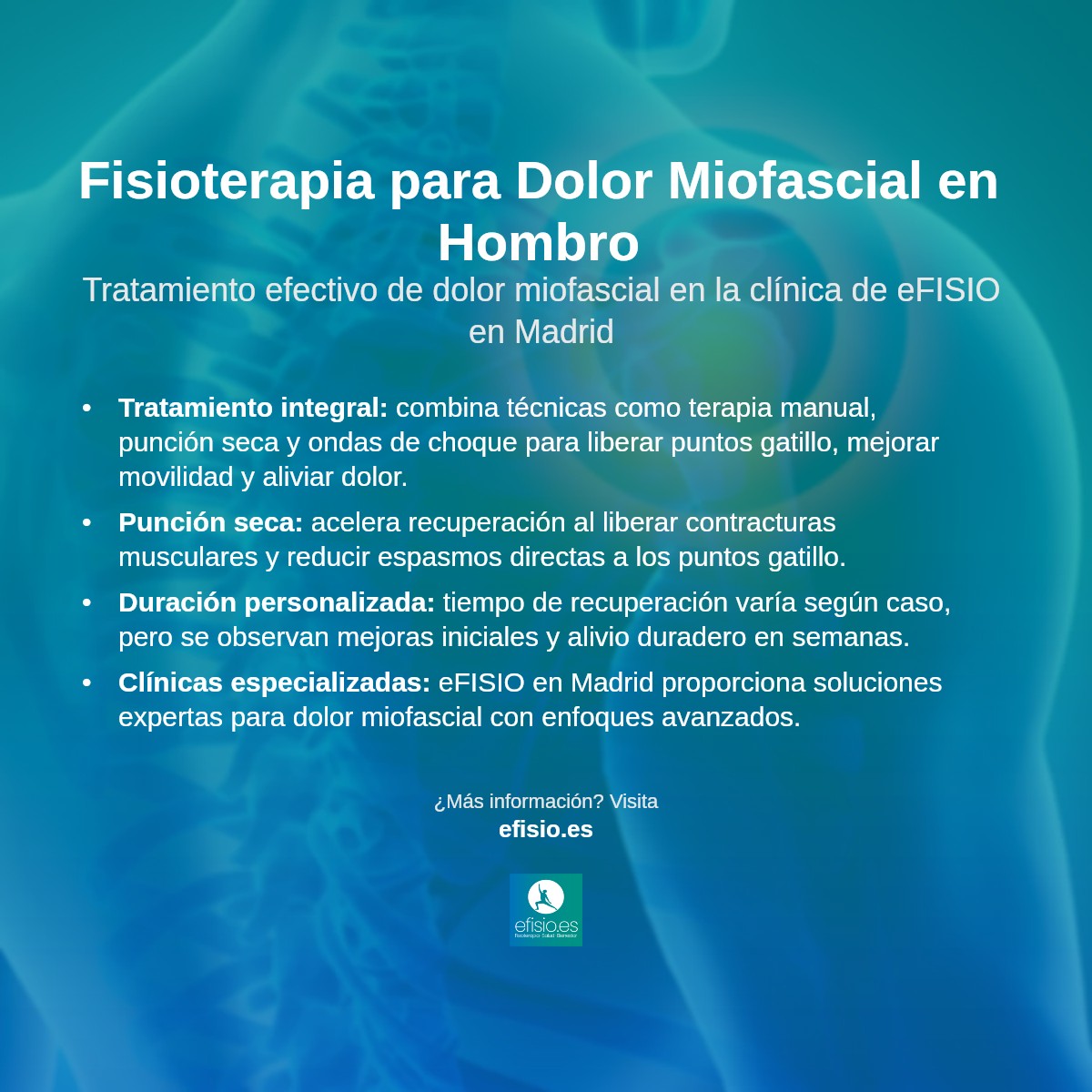 Imagen resumen sobre Dolor Miofascial en el Área del Hombro