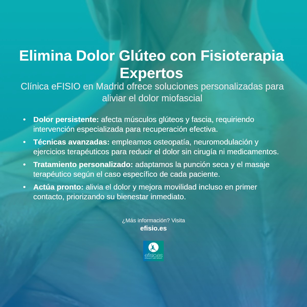 Imagen resumen sobre Dolor Miofascial en la Región Glútea