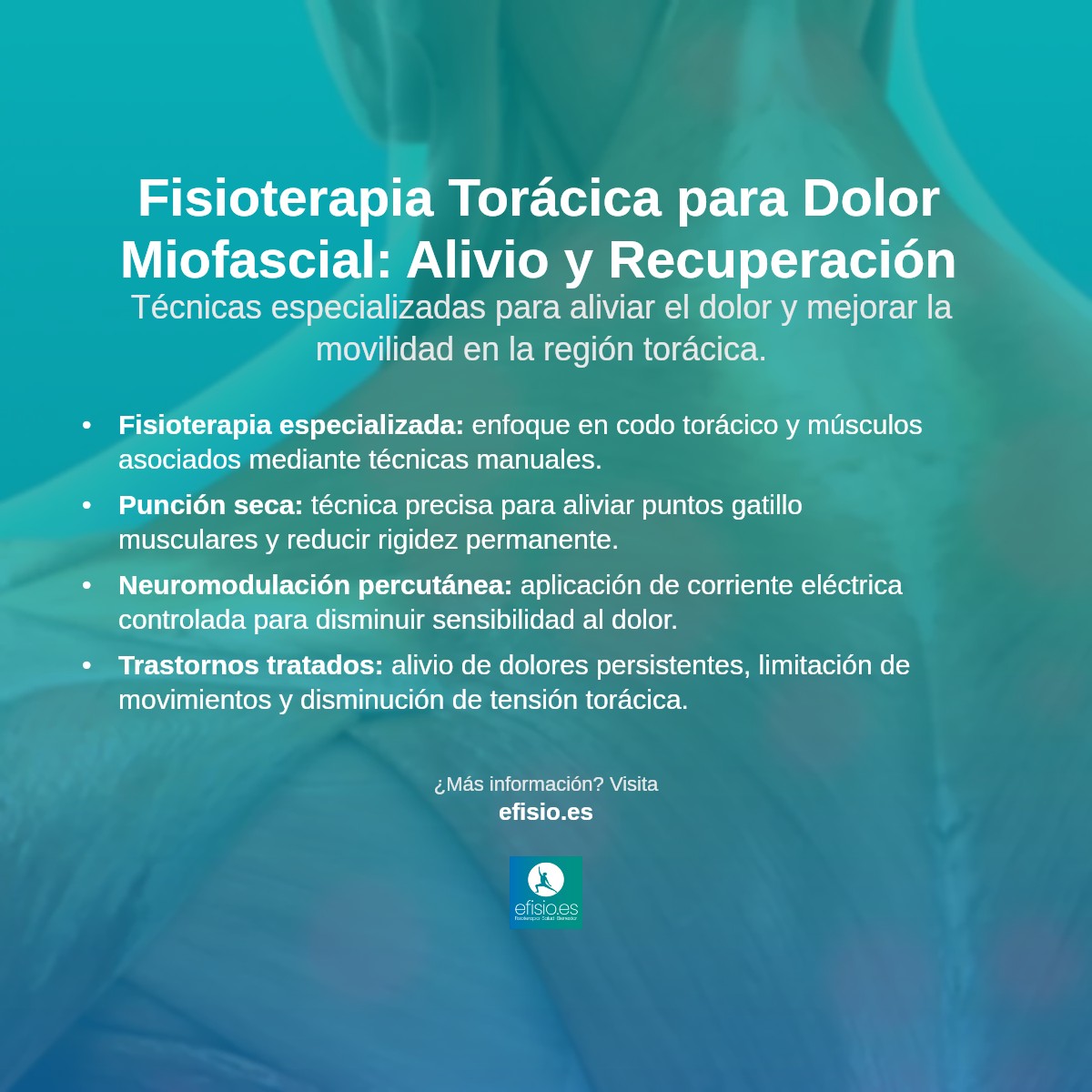 Imagen resumen sobre Dolor Miofascial en la Región Torácica