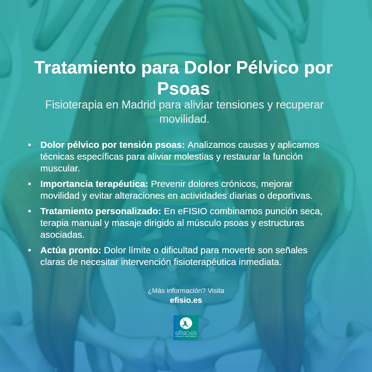 Imagen resumen sobre Dolor Pélvico Relacionado con el Psoas