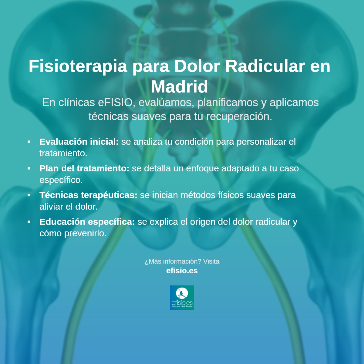 Imagen resumen sobre Dolor radicular