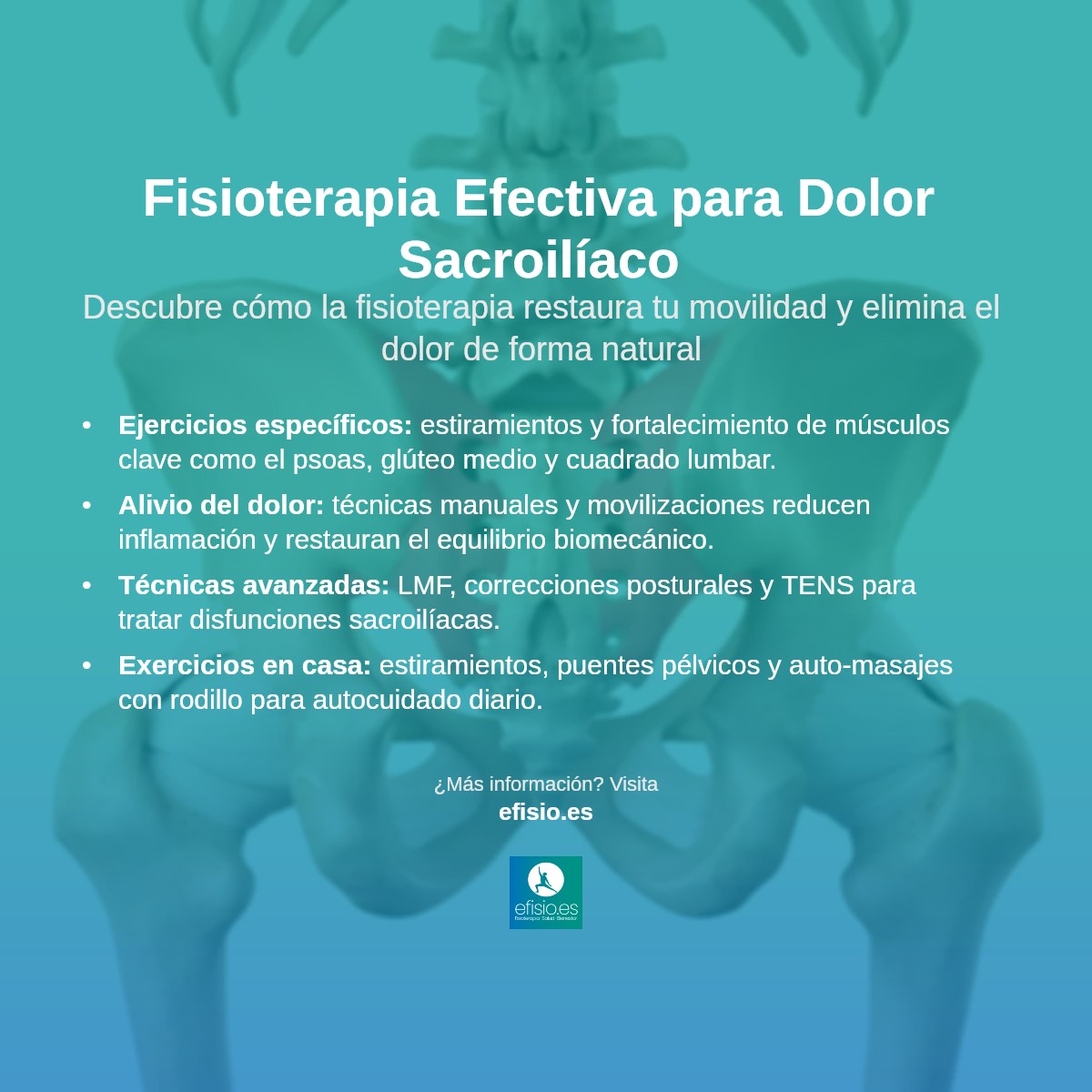 Imagen resumen sobre Dolor sacroilíaco