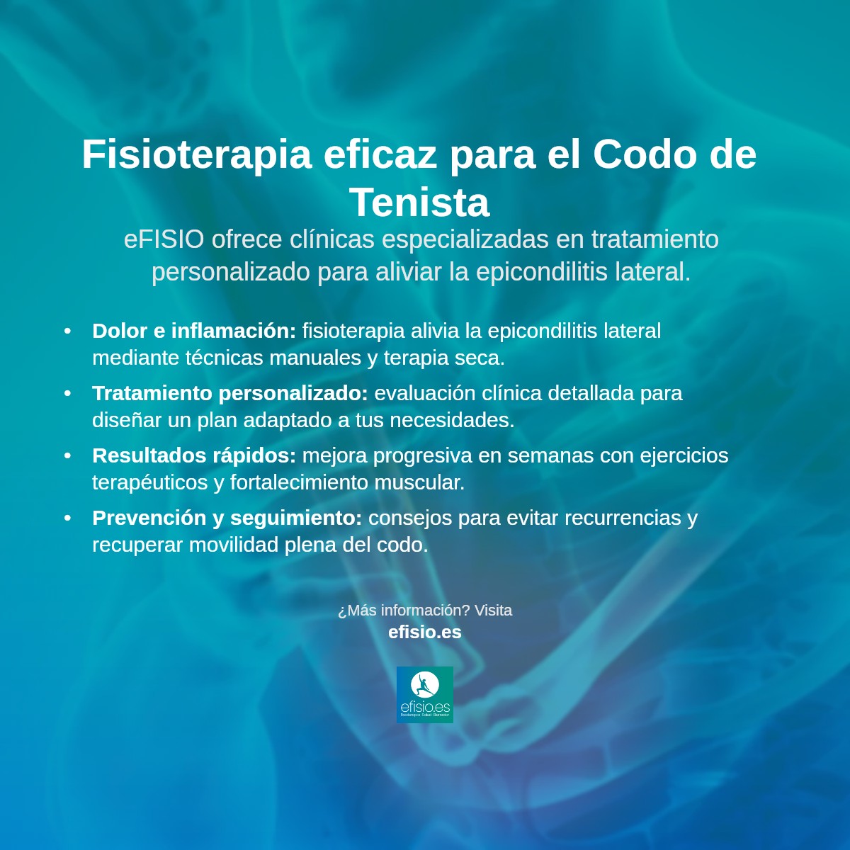 Imagen resumen sobre Epicondilitis Lateral (Codo de Tenista)