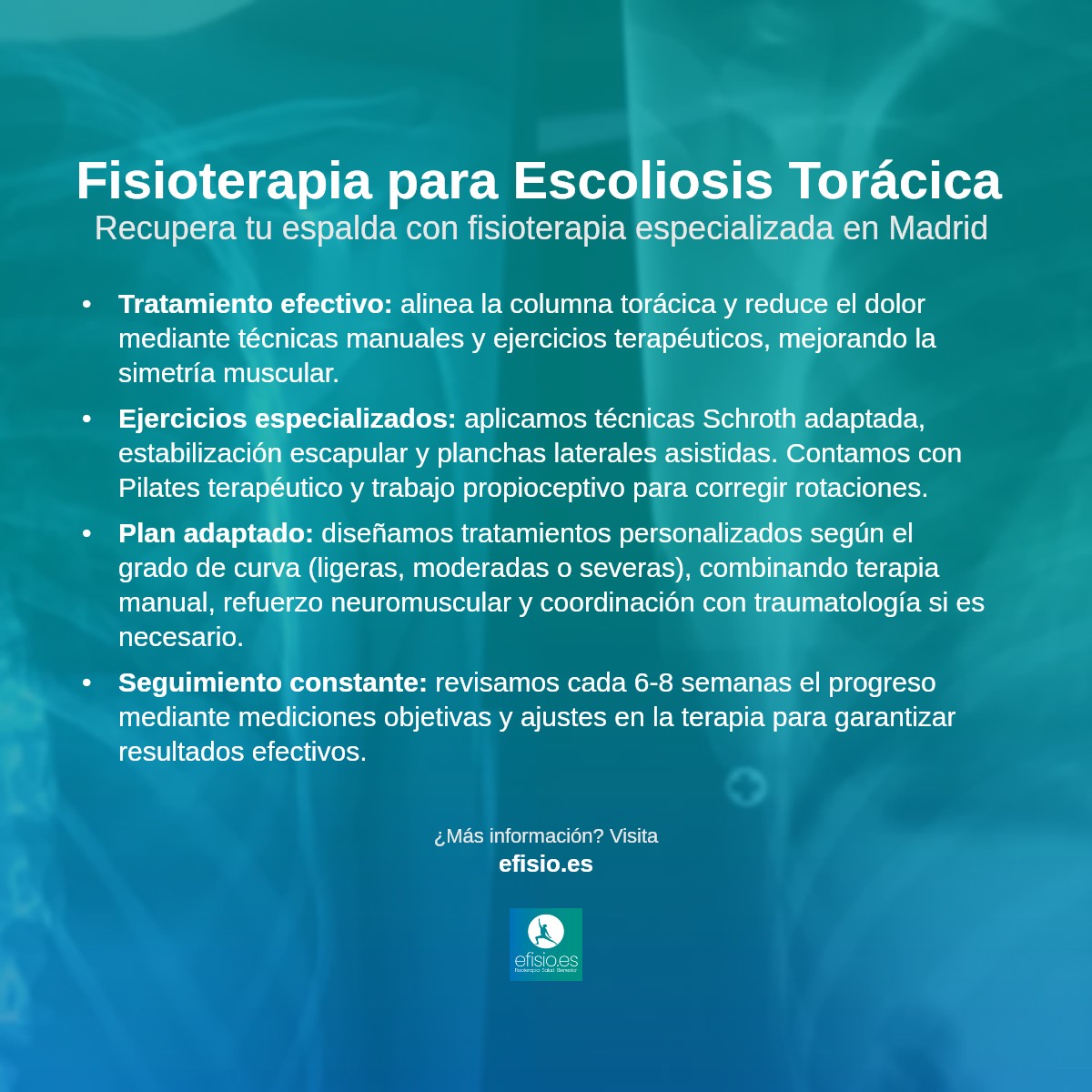 Imagen resumen sobre Escoliosis Torácica