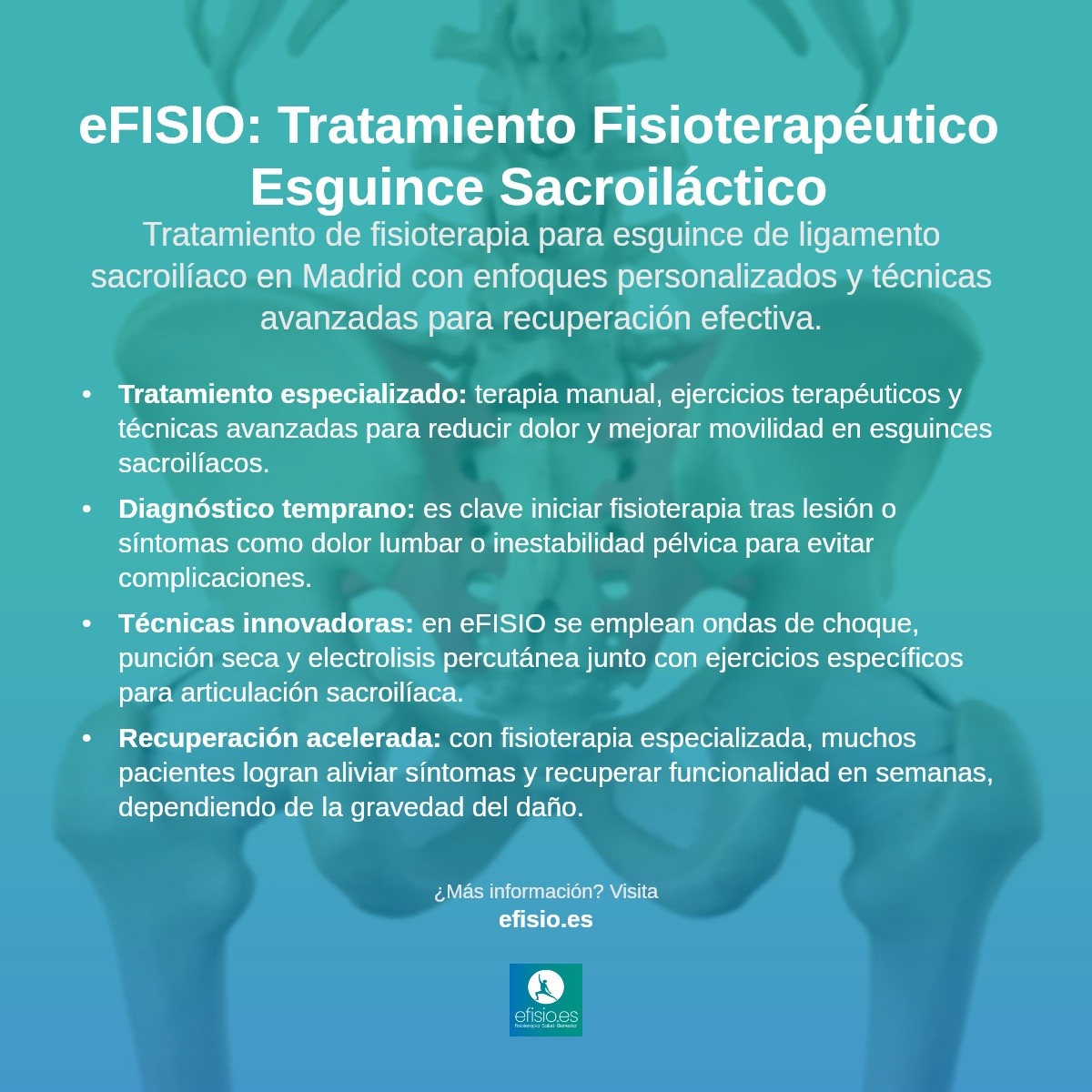 Imagen resumen sobre Esguince de Ligamento Sacroilíaco