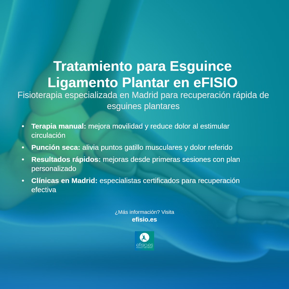 Imagen resumen sobre Esguince del Ligamento Plantar