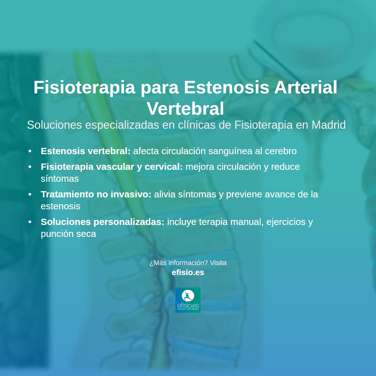 Imagen resumen sobre Estenosis de la Arteria Vertebral