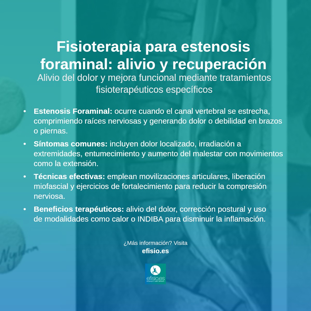 Imagen resumen sobre Estenosis Foraminal