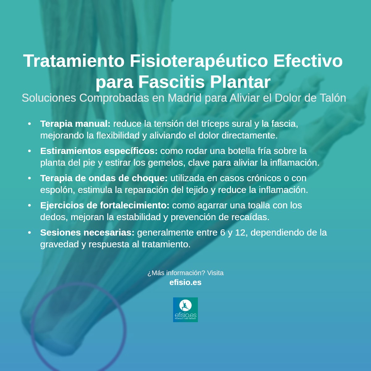 Imagen resumen sobre Fascitis plantar