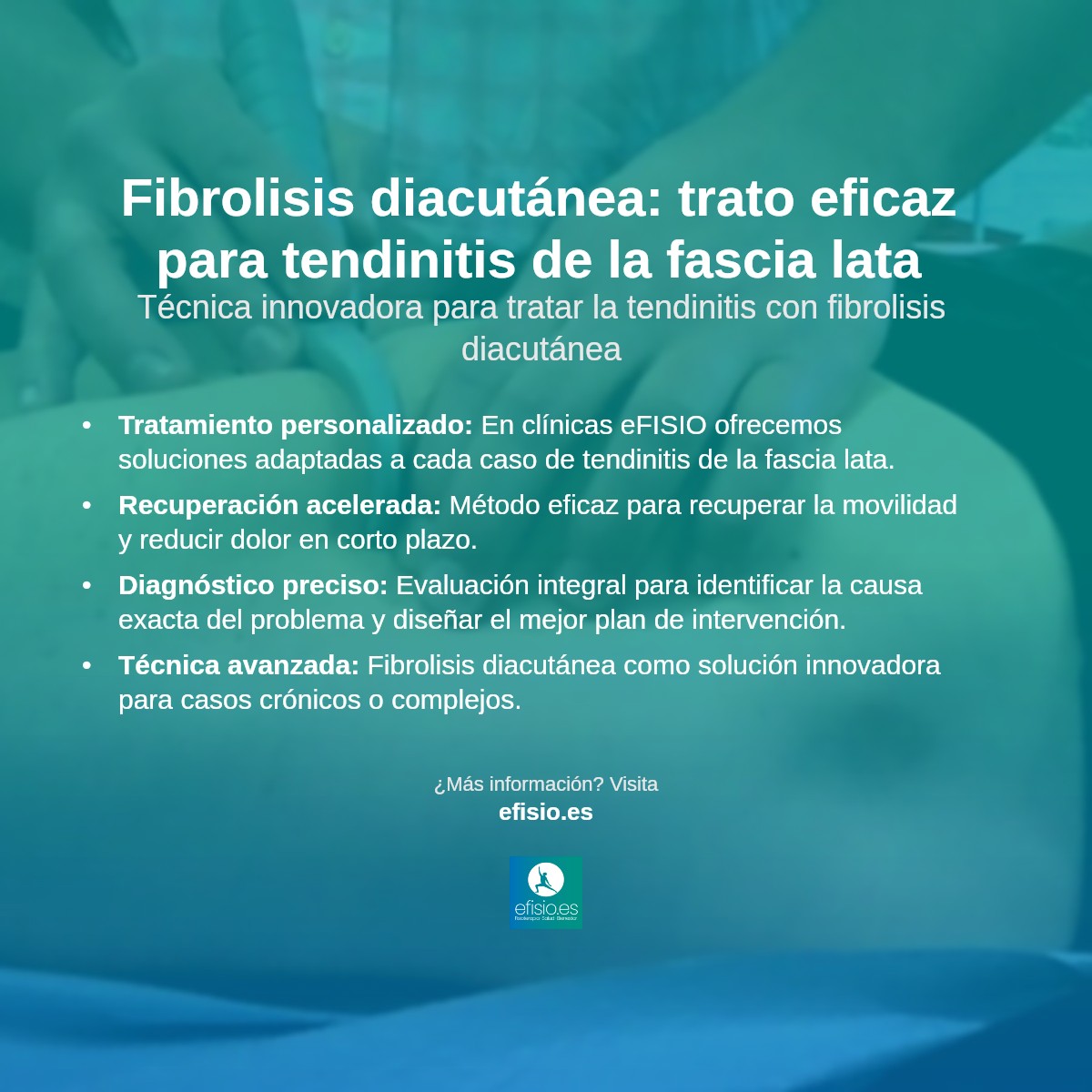 Imagen resumen sobre Fibrolisis diacutánea o técnica de los ganchos