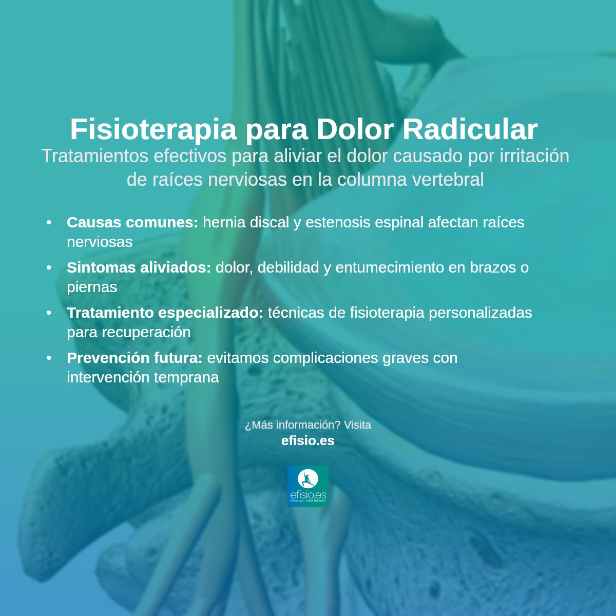 Imagen resumen sobre Fisioterapia para Dolor Radicular