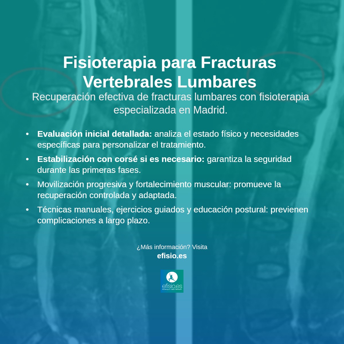 Imagen resumen sobre Fracturas Vertebrales Lumbares