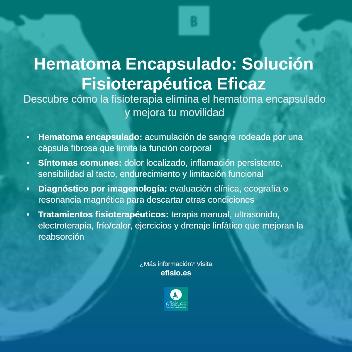 Imagen resumen sobre Hematoma encapsulado