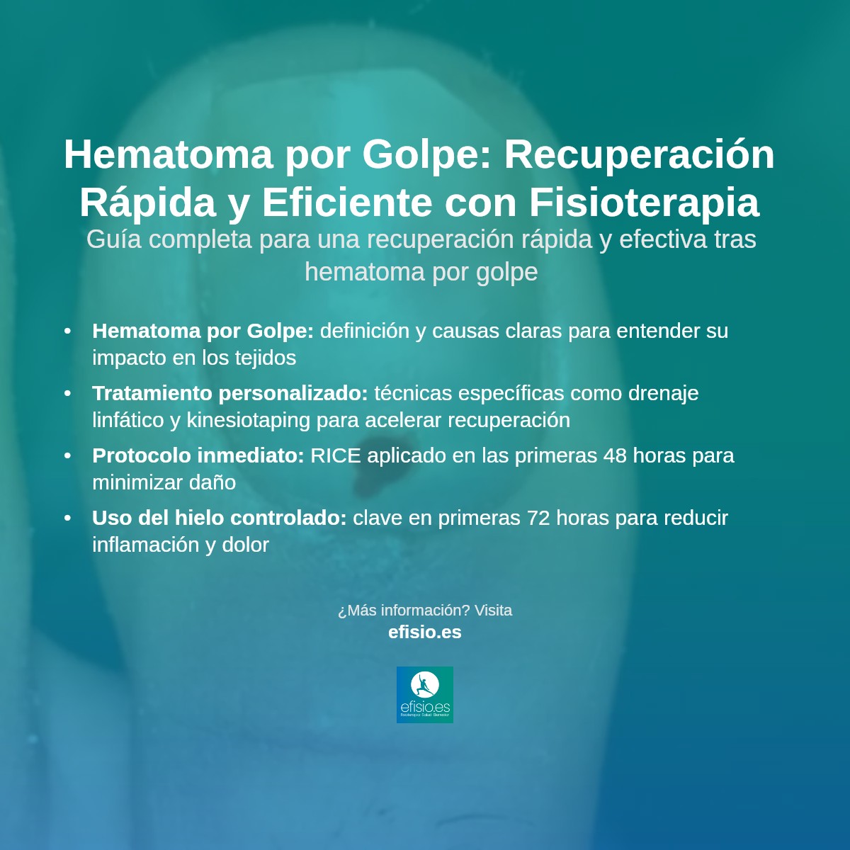 Imagen resumen sobre Hematoma por golpe
