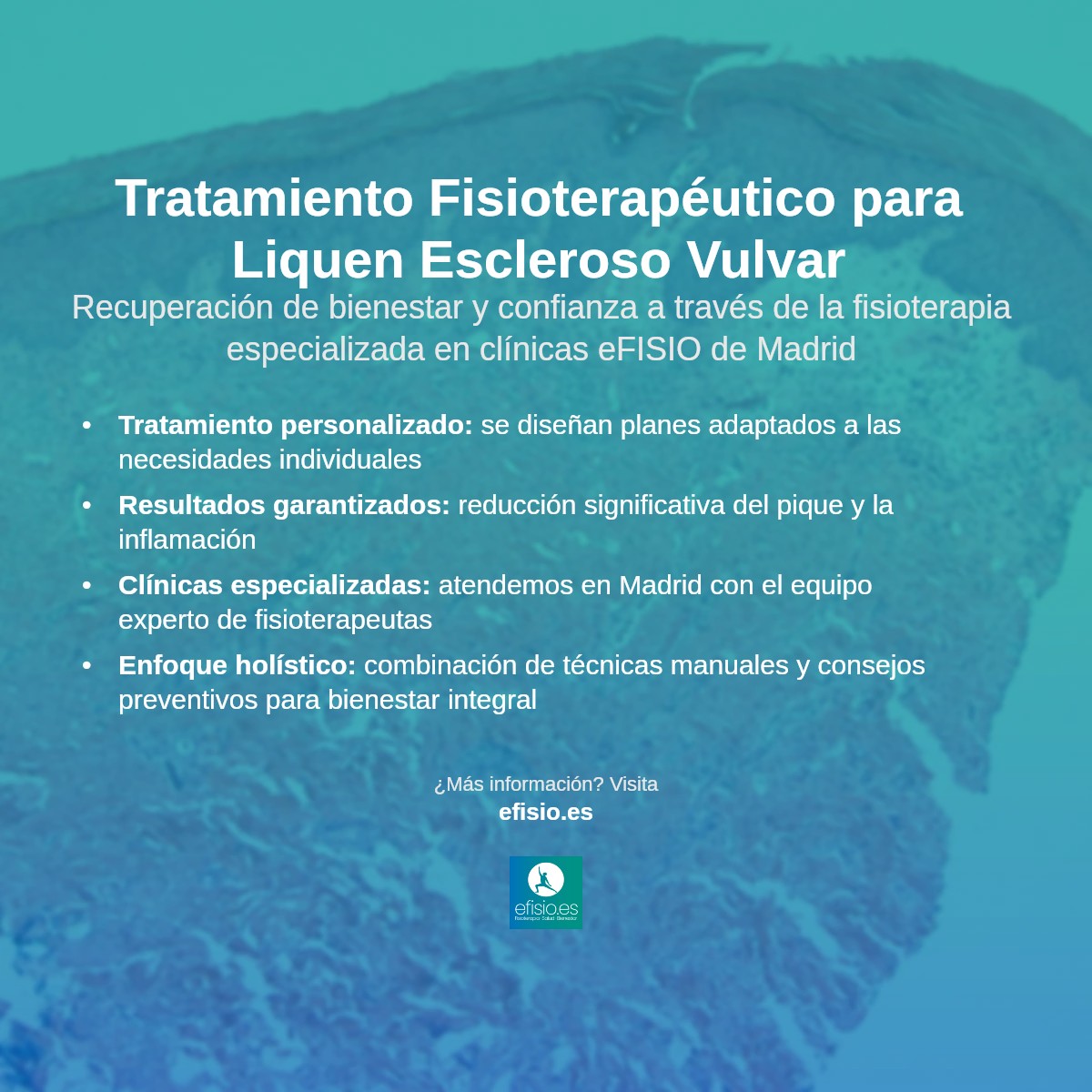 Imagen resumen sobre Liquen Escleroso Vulvar