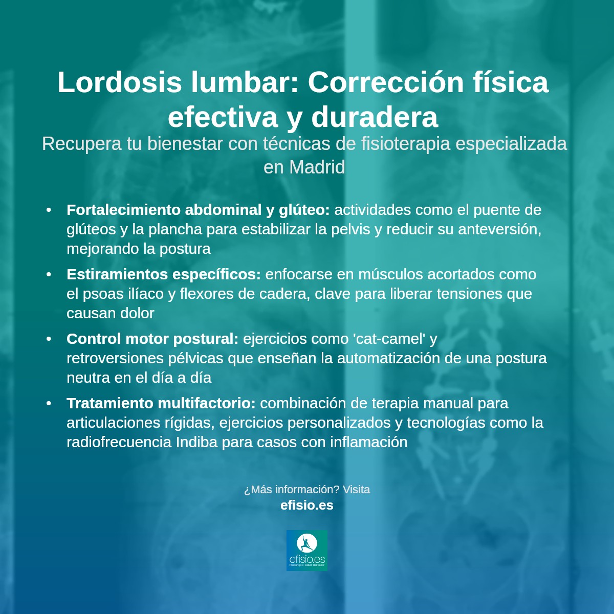 Imagen resumen sobre Lordosis