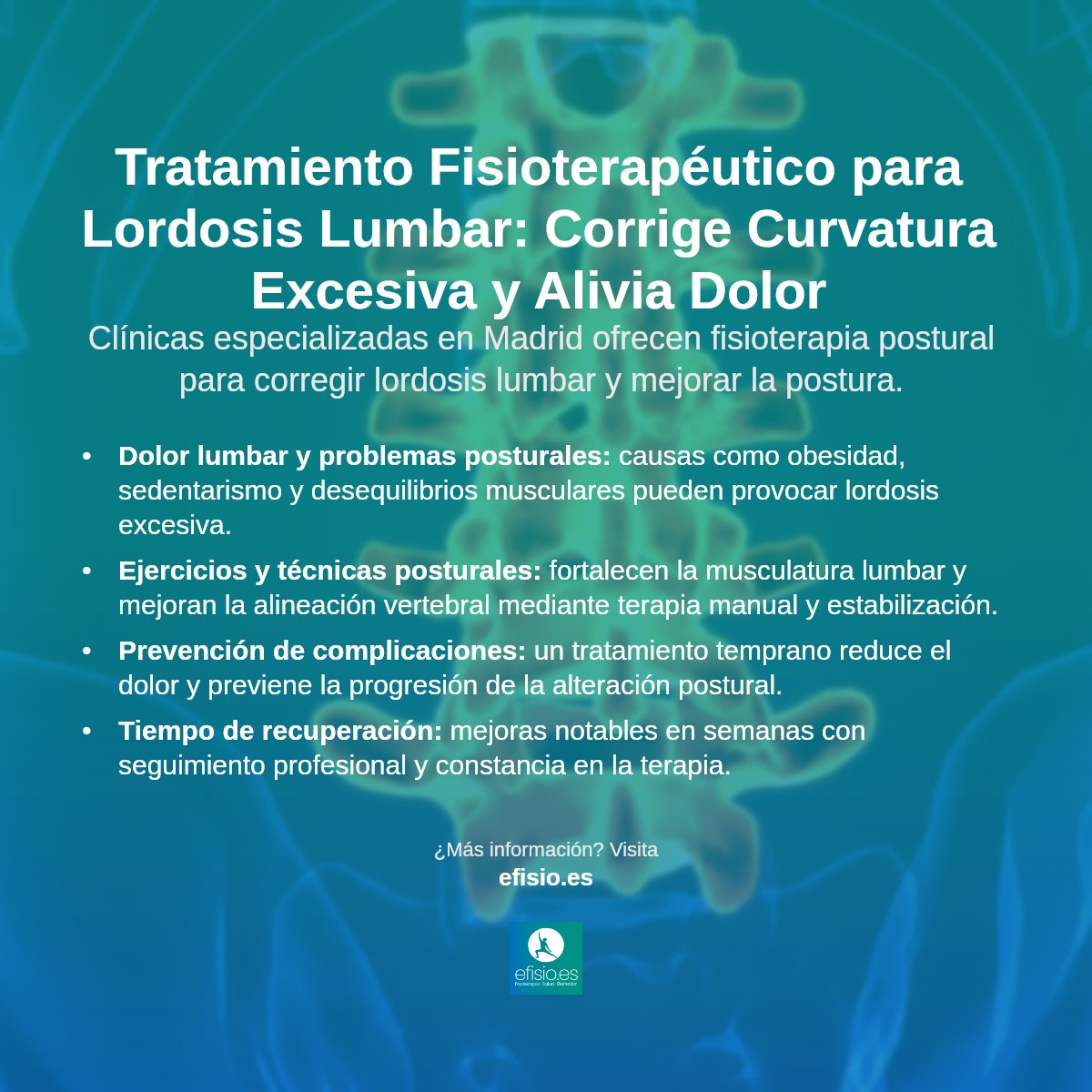 Imagen resumen sobre Lordosis Lumbar Excesiva