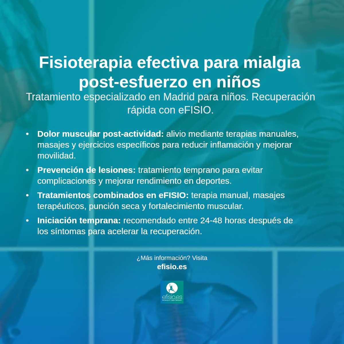 Imagen resumen sobre Mialgia post-esfuerzo