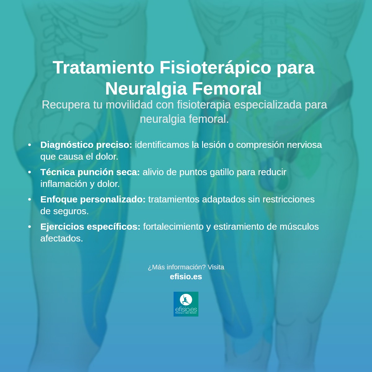 Imagen resumen sobre Neuralgia del Femoral