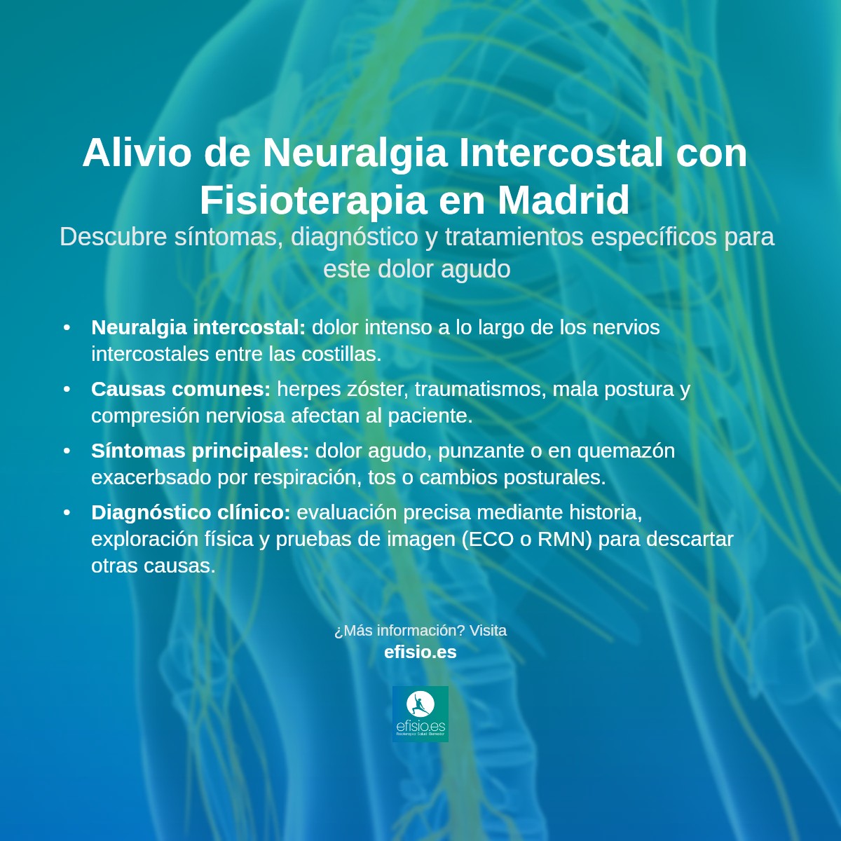 Imagen resumen sobre Neuralgia Intercostal