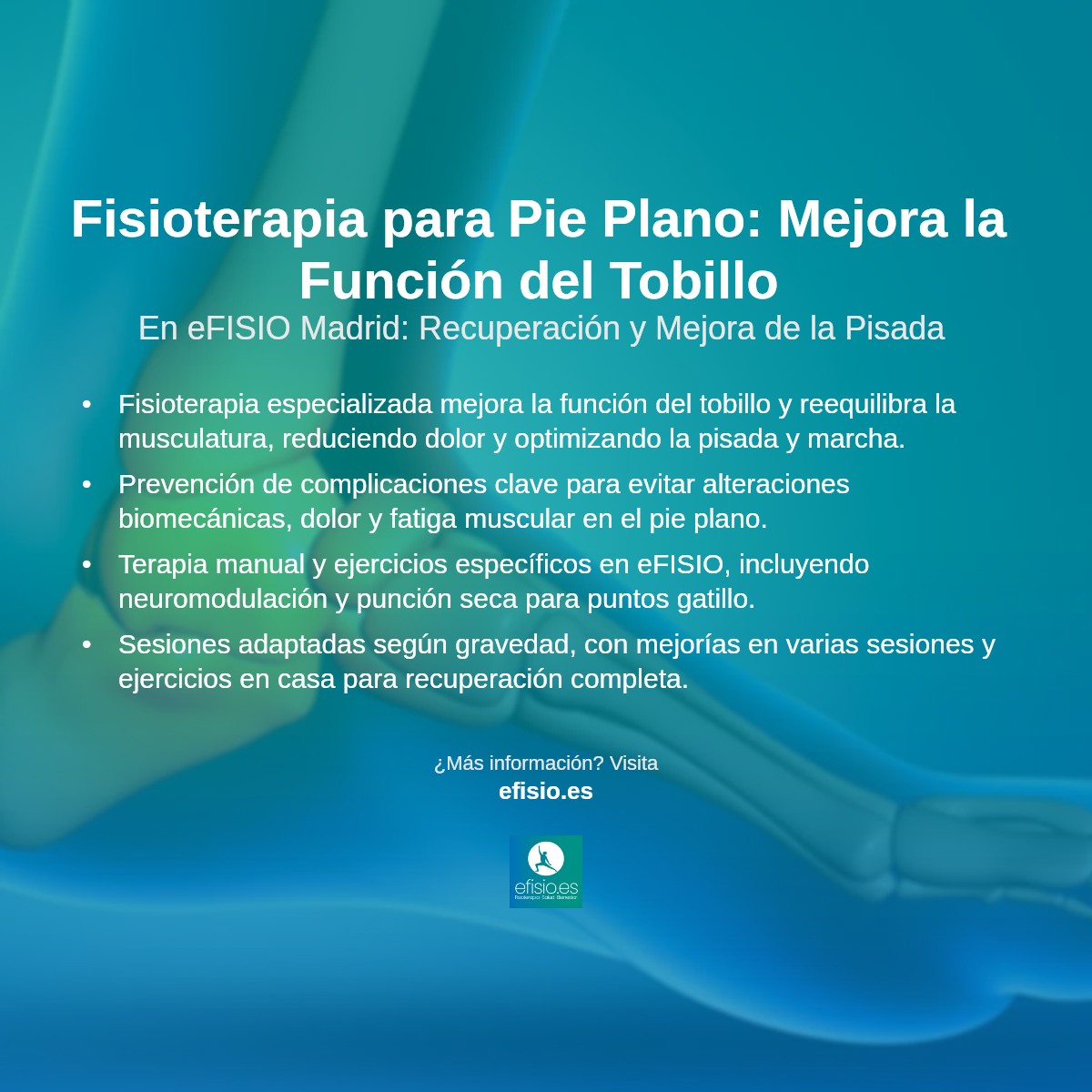 Imagen resumen sobre Pie Plano (Afectando la Función del Tobillo)