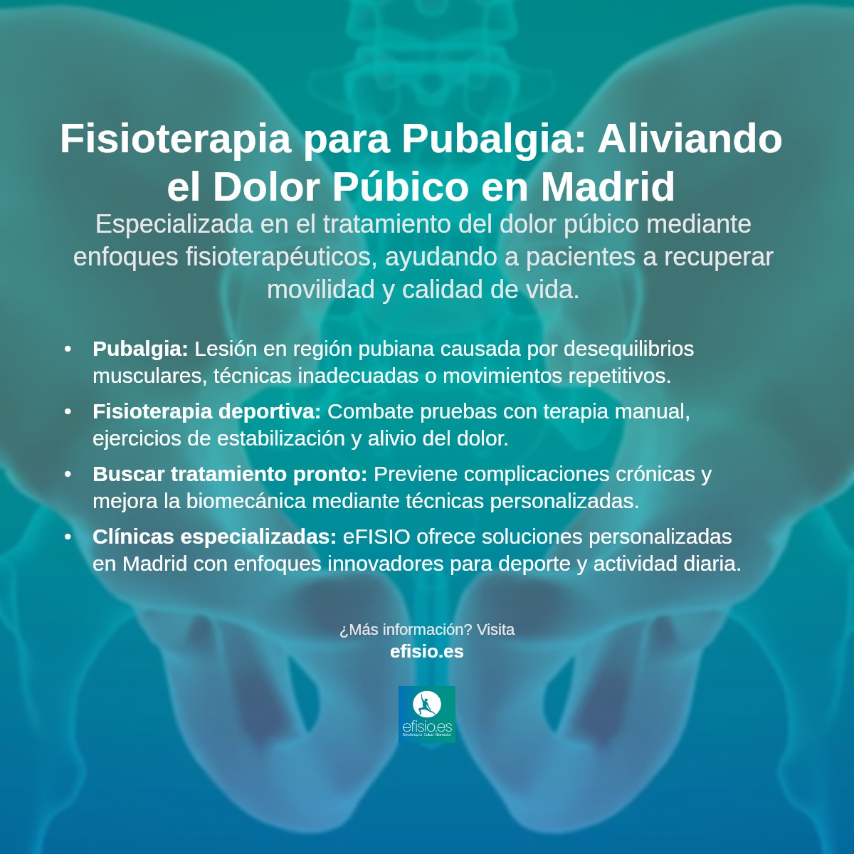 Imagen resumen sobre Pubalgia (Dolor Púbico)