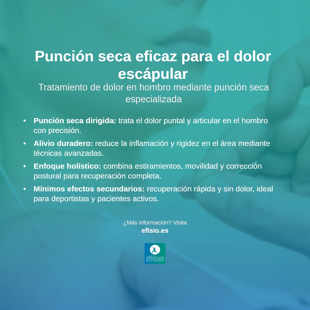 Imagen resumen sobre Punción seca del hombro