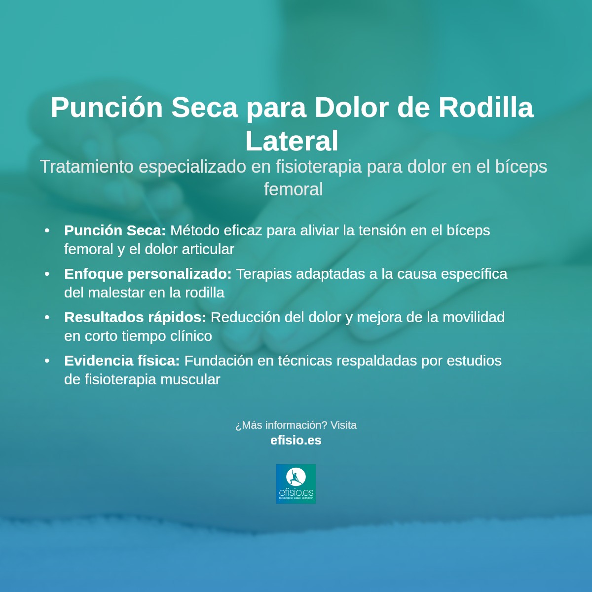Imagen resumen sobre Punción Seca para el Dolor de Rodilla Lateral