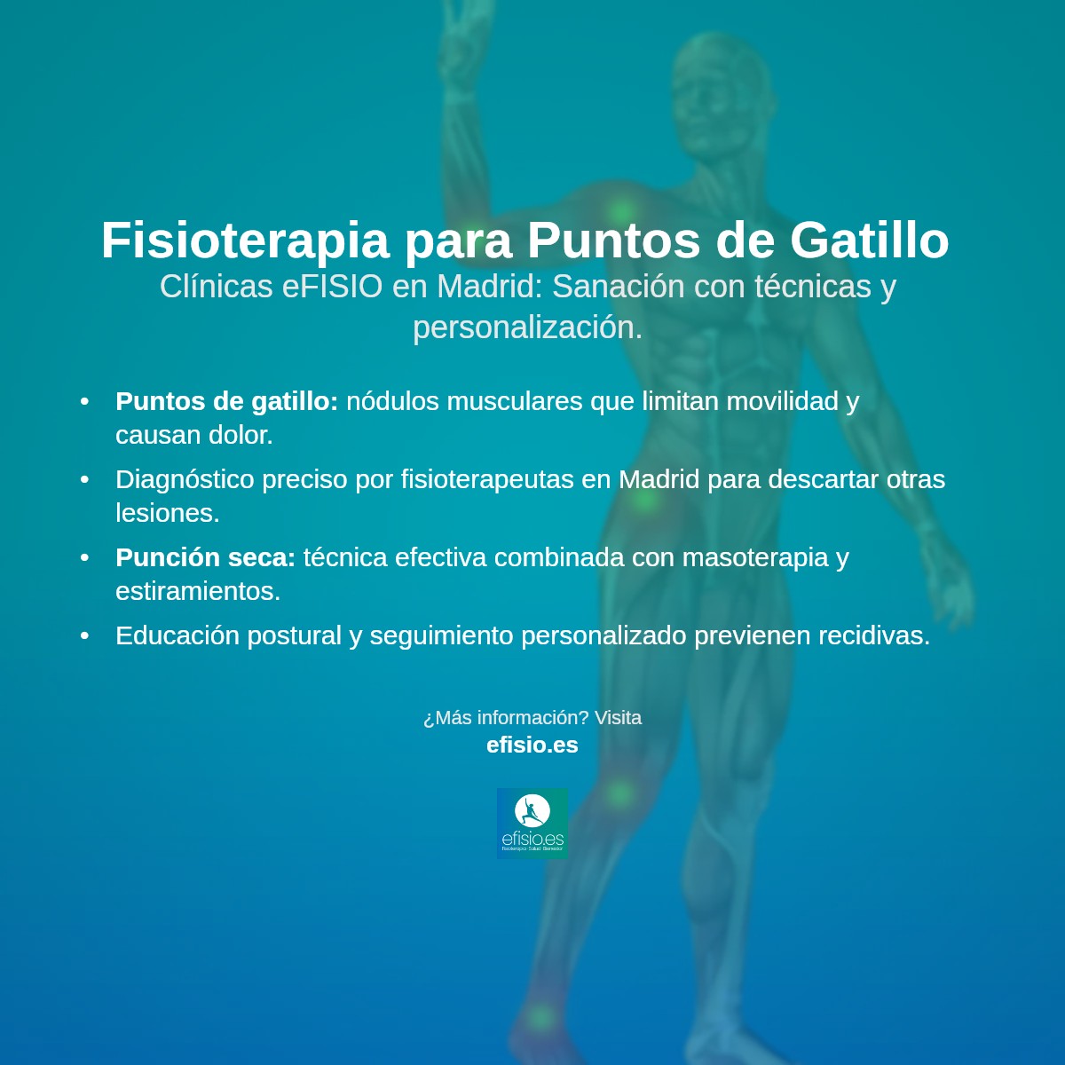 Imagen resumen sobre Punto de Gatillo