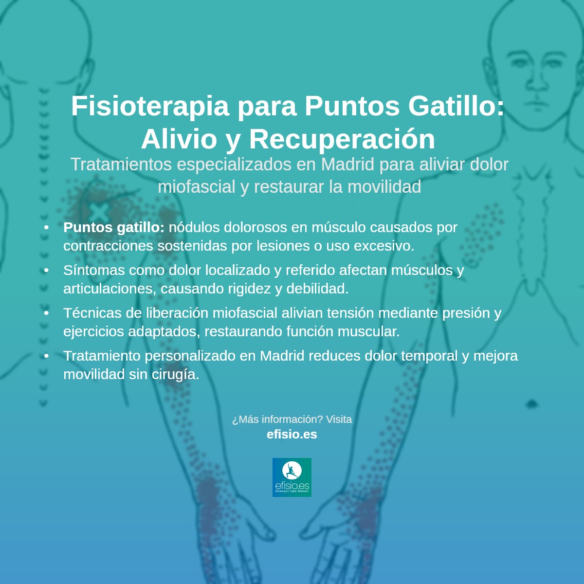 Imagen resumen sobre Puntos Gatillo Miofasciales