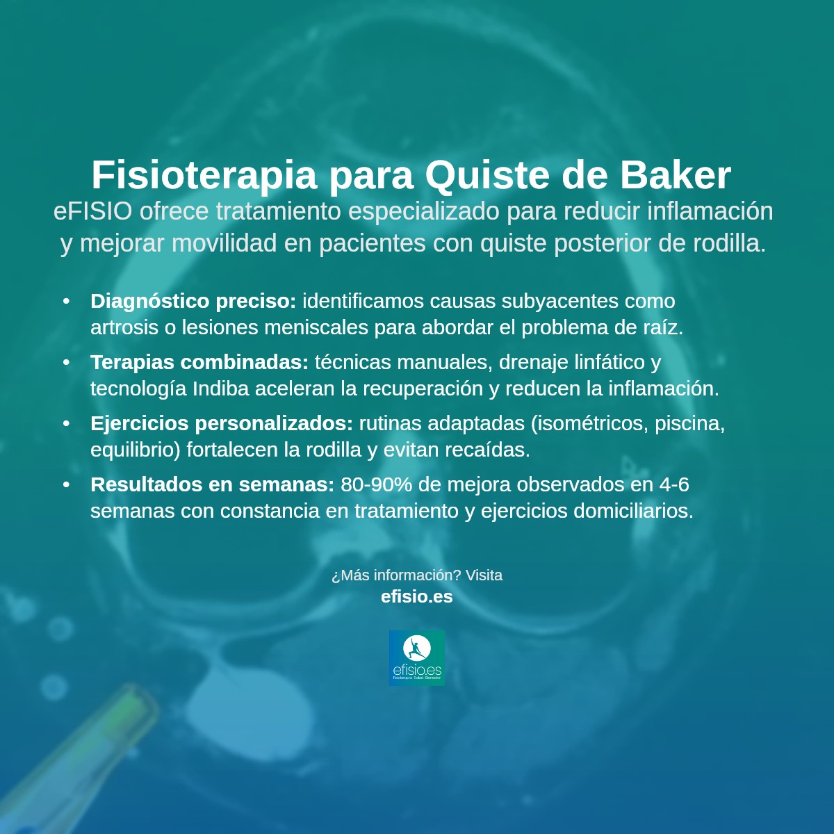 Imagen resumen sobre Quiste de Baker