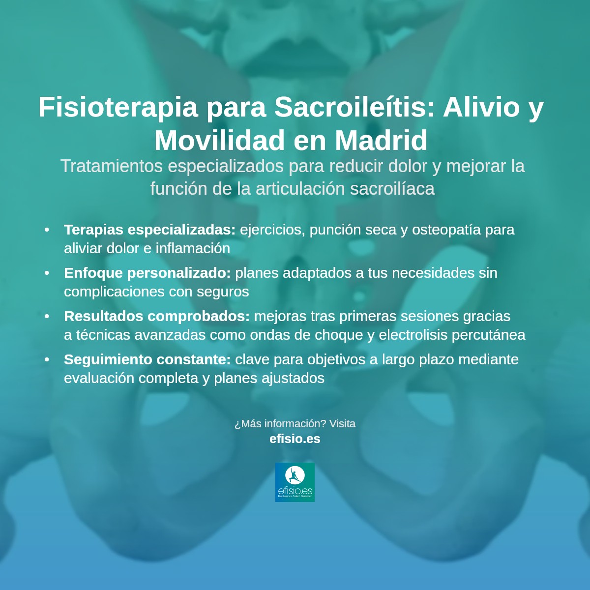 Imagen resumen sobre Sacroileítis (Dolor en la Articulación Sacroilíaca)