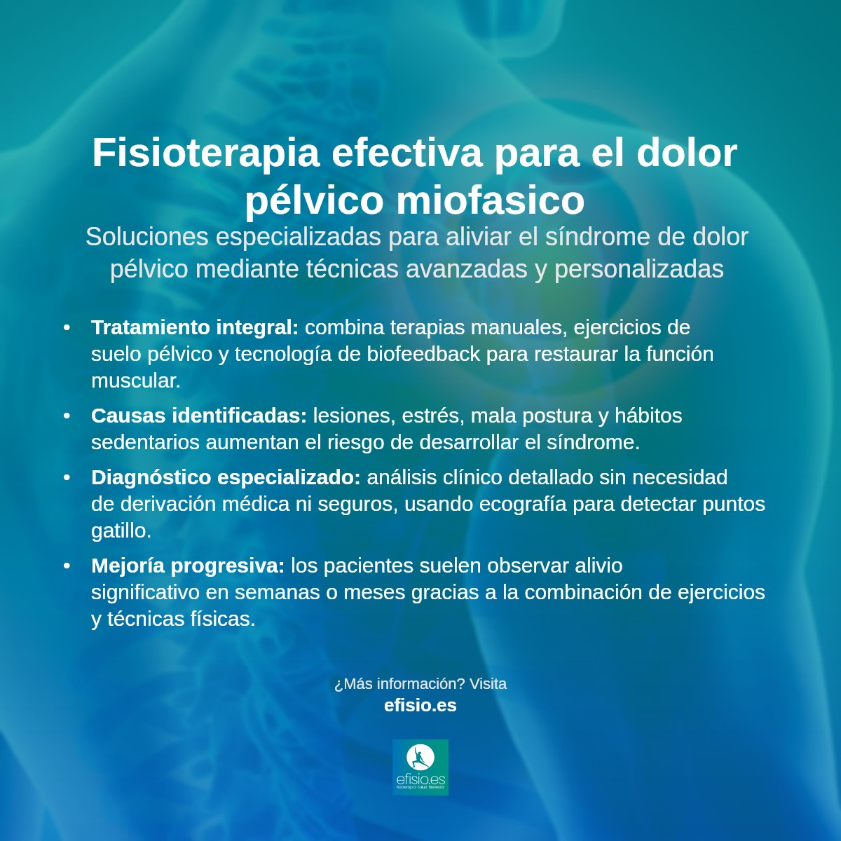 Imagen resumen sobre Síndrome de dolor miofascial pélvico